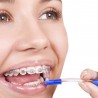 ​Акции на брекеты в стоматологии - отличный шанс получить красивую и здоровую улыбку